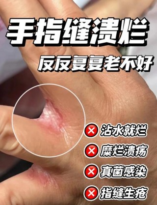 雪梨推荐笔记本电脑的简单介绍