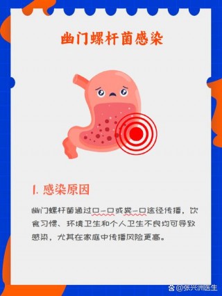 hp感染会传染吗？hp 感染什么意思