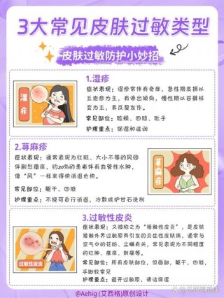 去角质笔记本电脑推荐？去角质性价比高的产品