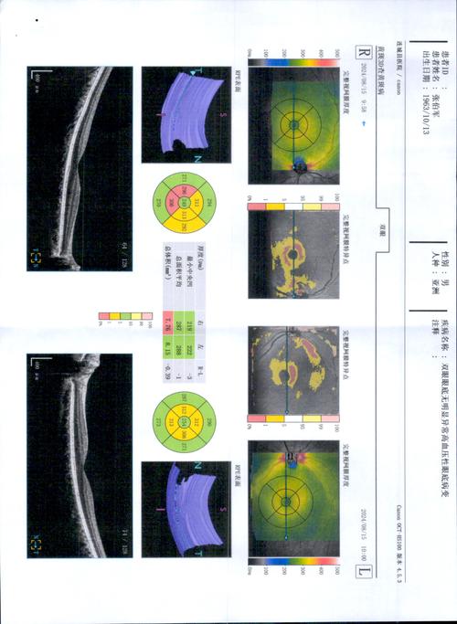 视网膜分辨率是多少ppi