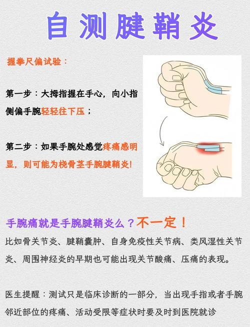 腱鞘炎和鼠标手的治疗有什么不同