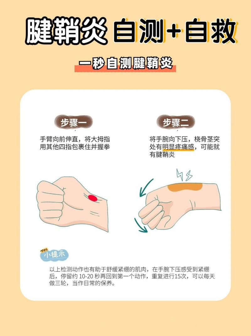 鼠标手是怎么回事