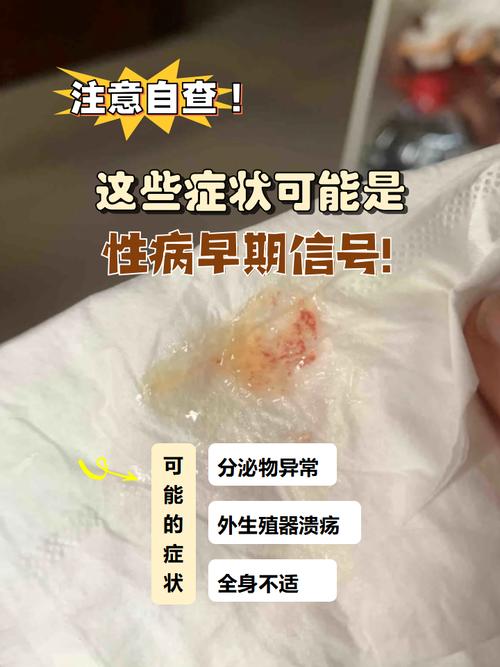 Hp感染的发生及传播途径:一种家庭事件?