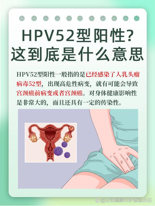 高危型HPV52阳性是什么原因引起的