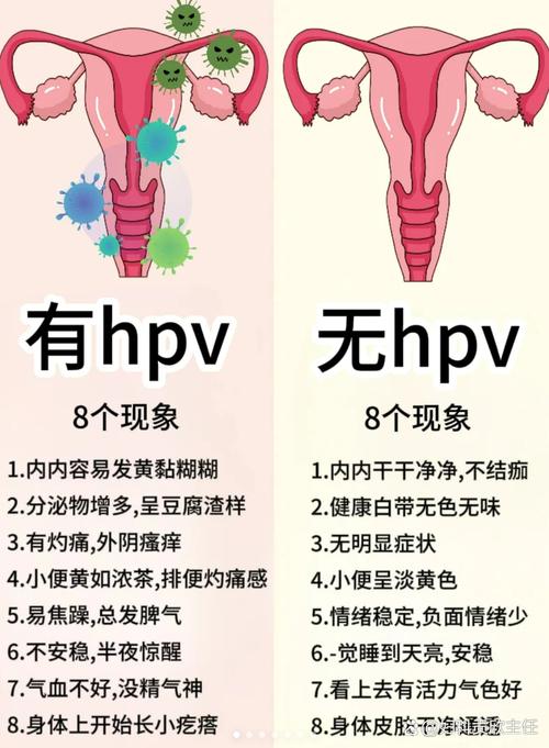 身体突然出现哪些“疼”痛感,或暗示感染HPV,需趁早检查?