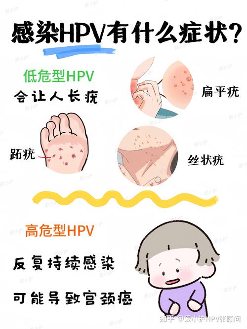 宫颈HPV感染能治愈吗