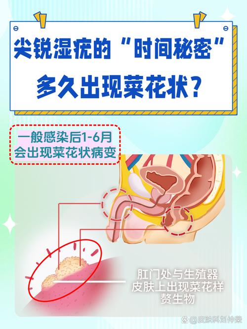 hpv感染要禁欲多久