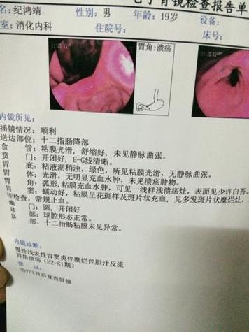 幽门螺杆菌阳性HP(+)c=00058严重吗?