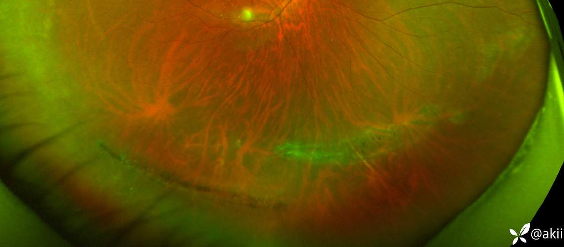 苹果的liquid显示屏和超视网膜显示屏有什么区别?