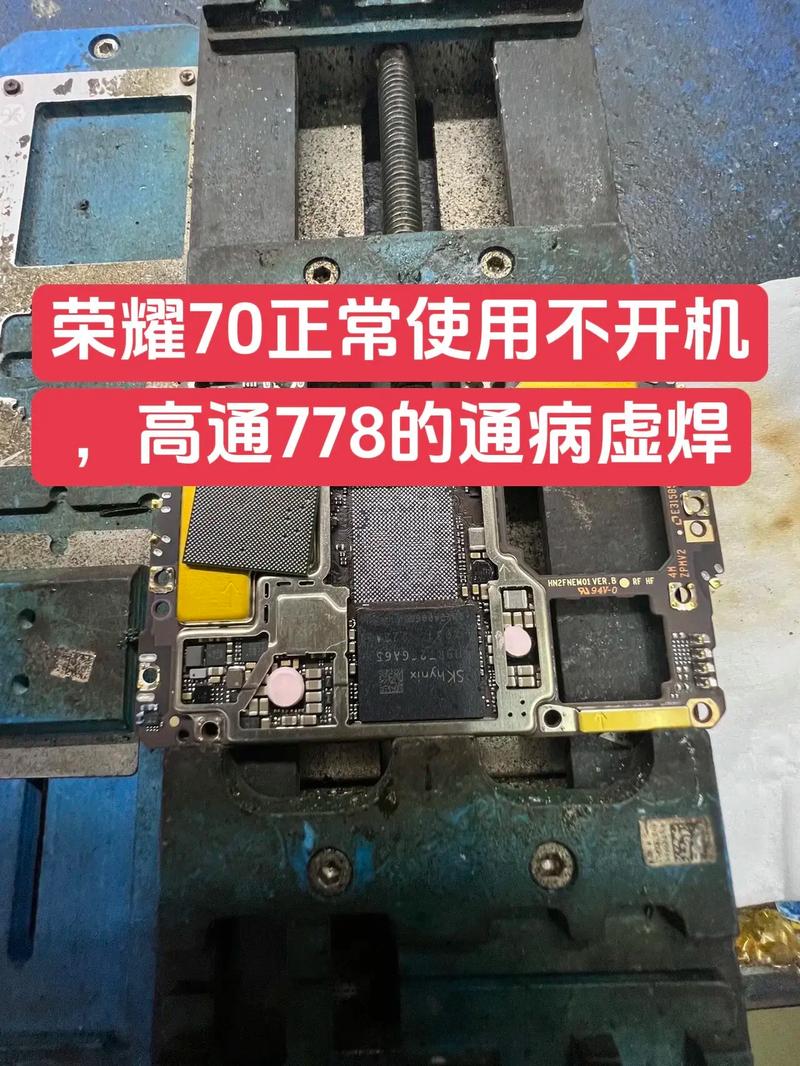 荣耀70的通病有哪些