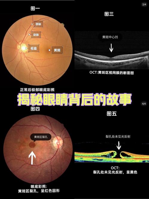 xdr屏幕是什么意思
