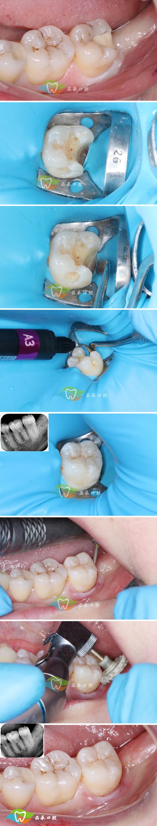 苹果笔记本电脑怎么下载牙医管家?