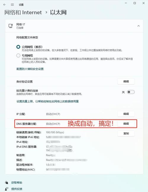 windows网络诊断dns服务器可能不可用